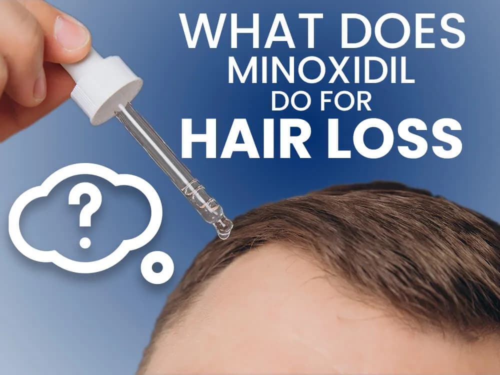 Minoxidil Uncovered: The Science of Hair Regrowth image